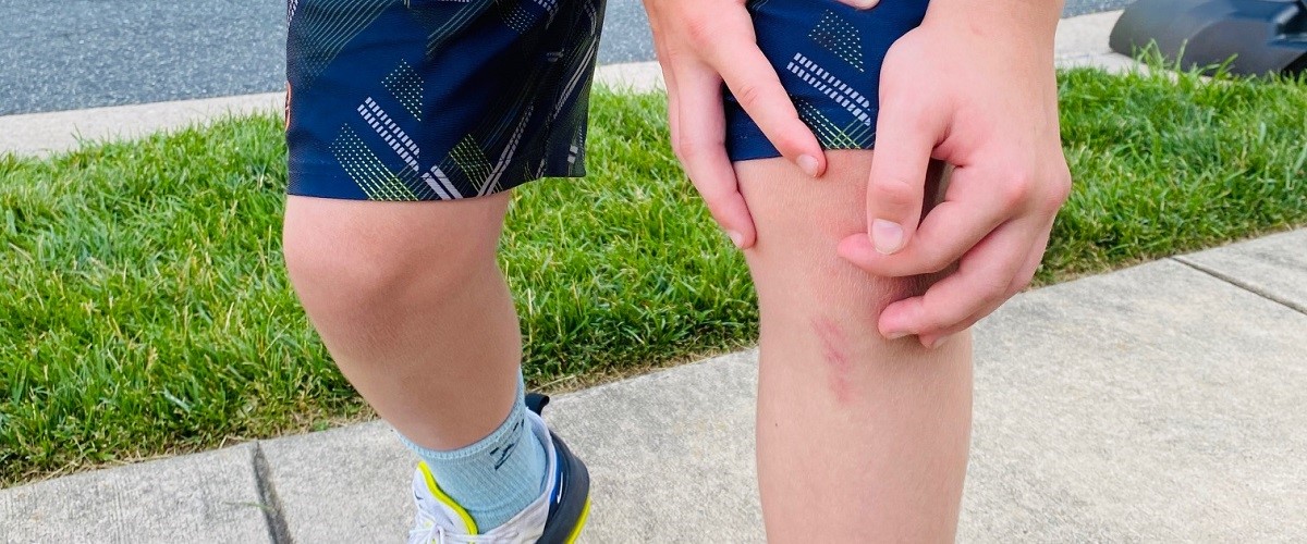 Sports Injuries Return to Play